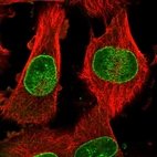 Immunofluorescent staining of human cell line U-251 MG shows localization to nuclear membrane.