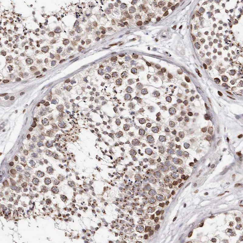 Anti-NUP153 Antibody