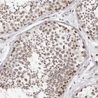 Anti-NUP153 Antibody