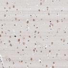 Immunohistochemical staining of human cerebral cortex shows moderate to strong positivity in nuclear membrane in neurons.