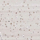 Immunohistochemical staining of human cerebral cortex shows moderate to strong positivity in nuclear membrane in neurons.