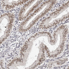 Immunohistochemical staining of human endometrium shows weak to moderate positivity in nuclear membrane in glandular cells.