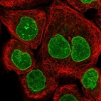 Immunofluorescent staining of human cell line A-431 shows localization to nuclear membrane.
