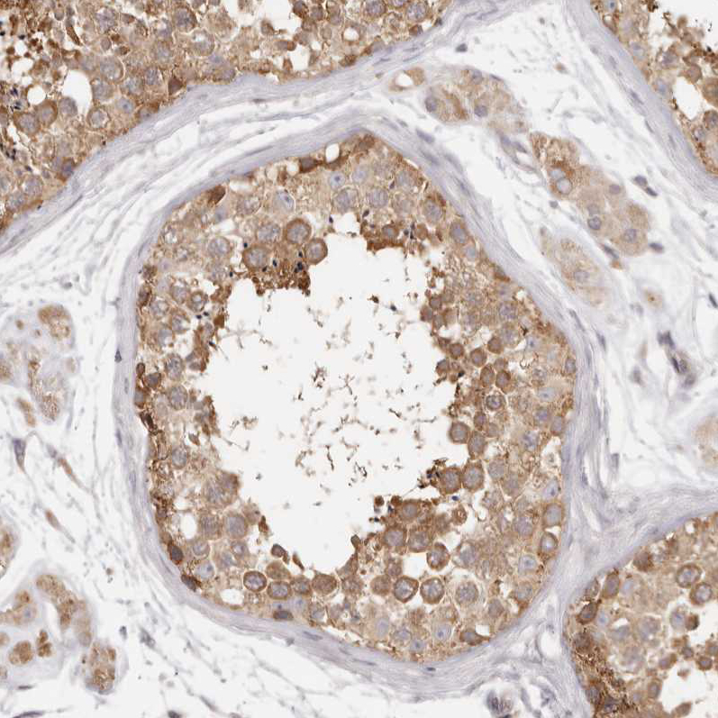 Anti-EEF1E1 Antibody