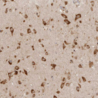 Immunohistochemical staining of human cerebral cortex shows strong cytoplasmic positivity in neurons.