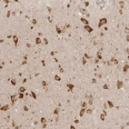 Immunohistochemical staining of human cerebral cortex shows strong cytoplasmic positivity in neurons.