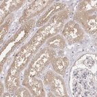 Immunohistochemical staining of human kidney shows moderate cytoplasmic positivity in cells in tubules.