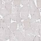 Immunohistochemical staining of human skeletal muscle shows no positivity in myocytes as expected.