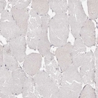 Immunohistochemical staining of human skeletal muscle shows no positivity in myocytes as expected.