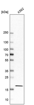 Western blot analysis in human cell line K562.