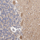 Anti-DOPEY1 Antibody