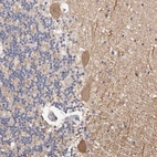 Anti-DOPEY1 Antibody