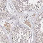 Immunohistochemical staining of human testis shows moderate cytoplasmic positivity in Leydig cells.