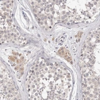 Immunohistochemical staining of human testis shows moderate cytoplasmic positivity in Leydig cells.