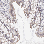 Immunohistochemical staining of human rectum shows weak cytoplasmic positivity in glandular cells.