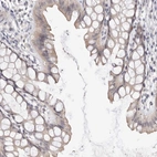 Immunohistochemical staining of human rectum shows weak cytoplasmic positivity in glandular cells.