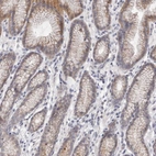 Immunohistochemical staining of human stomach shows weak cytoplasmic positivity in glandular cells.