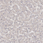 Immunohistochemical staining of human liver shows no positivity in hepatocytes as expected.