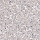 Immunohistochemical staining of human liver shows no positivity in hepatocytes as expected.