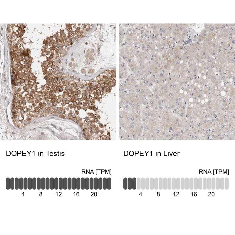 Anti-DOPEY1 Antibody