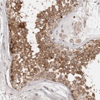 Immunohistochemical staining of human testis shows high expression.