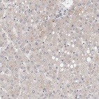 Immunohistochemical staining of human liver shows low expression as expected.