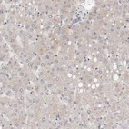 Immunohistochemical staining of human liver shows low expression as expected.