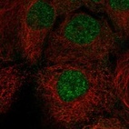 Anti-CTNNBL1 Antibody