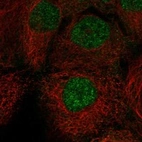 Immunofluorescent staining of human cell line CACO-2 shows localization to nucleoplasm.