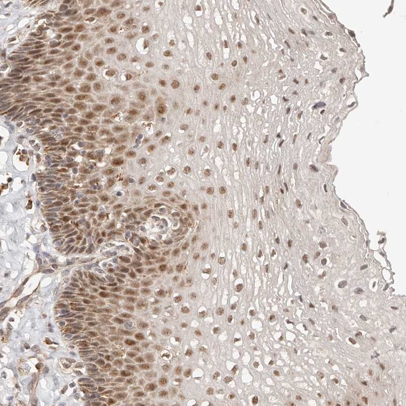 Anti-CTNNBL1 Antibody