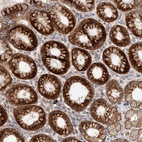 Anti-TBC1D22B Antibody