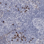Anti-TBC1D22B Antibody