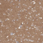 Immunohistochemical staining of human cerebral cortex shows moderate cytoplasmic positivity in neurons.