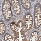 Immunohistochemical staining of human colon shows moderate cytoplasmic positivity in glandular cells.