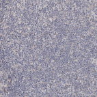 Immunohistochemical staining of human tonsil shows no positivity in germinal center cells as expected.