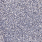 Immunohistochemical staining of human tonsil shows no positivity in germinal center cells as expected.