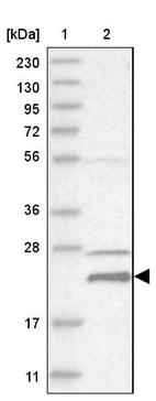 Lane 1: Marker [kDa] 230, 130, 95, 72, 56, 36, 28, 17, 11_br/_Lane 2: Human cell line RT-4
