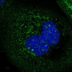 Immunofluorescent staining of human cell line A-431 shows positivity in nucleoli, cytoplasm & mitochondria.
