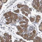 Anti-TPD52L1 Antibody