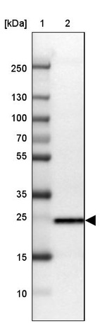 Lane 1: Marker [kDa] 250, 130, 100, 70, 55, 35, 25, 15, 10_br/_Lane 2: Human cell line MCF-7