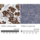 Anti-TPD52L1 Antibody