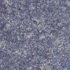 Immunohistochemical staining of human lymph node shows low expression as expected.