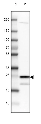 Lane 1: Marker [kDa] 250, 130, 100, 70, 55, 35, 25, 15, 10_br/_Lane 2: Human cell line MCF-7