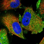 Immunofluorescent staining of human cell line U-251 MG shows localization to plasma membrane, cytosol & cell junctions.