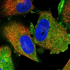 Immunofluorescent staining of human cell line U-251 MG shows localization to plasma membrane, cytosol & cell junctions.