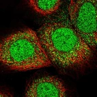 Immunofluorescent staining of human cell line A-431 shows localization to nucleoplasm & cytosol.