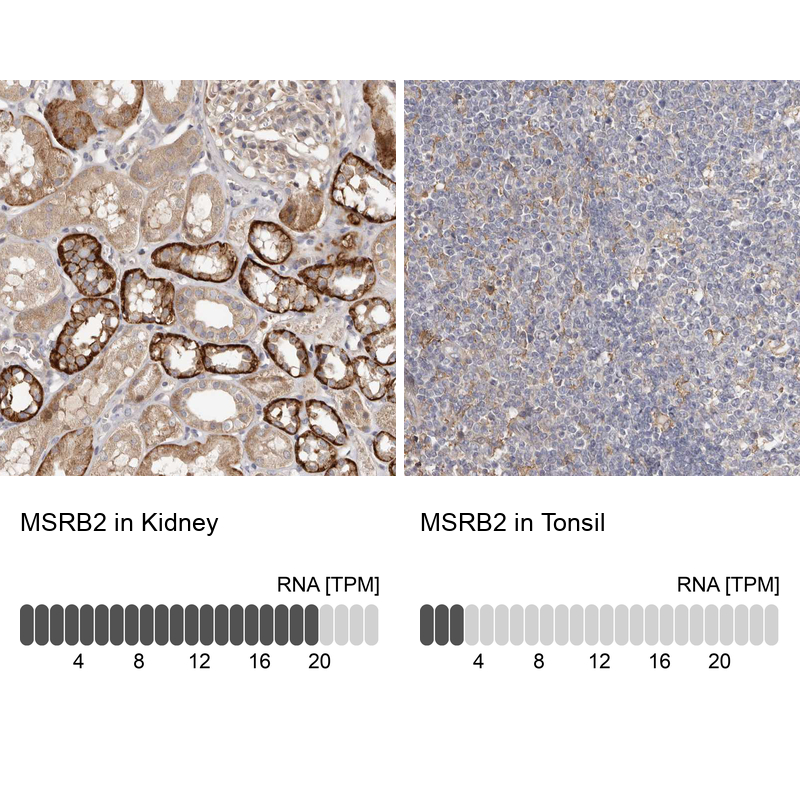 Anti-MSRB2 Antibody