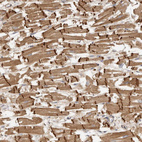 Immunohistochemical staining of human heart shows strong cytoplasmic positivity in cardiomyocytes.