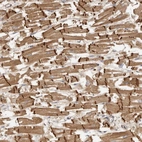 Immunohistochemical staining of human heart shows strong cytoplasmic positivity in cardiomyocytes.