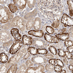 Immunohistochemical staining of human kidney shows moderate to strong cytoplasmic positivity in cells in tubules.